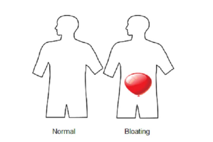 Stomach Bloating