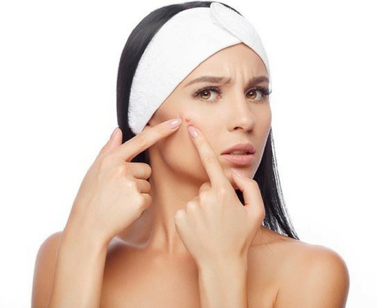 remedy for acne