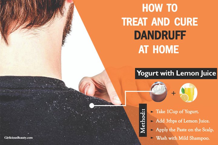 How to Remove Dandruff Permanently – Best Home Remedies.