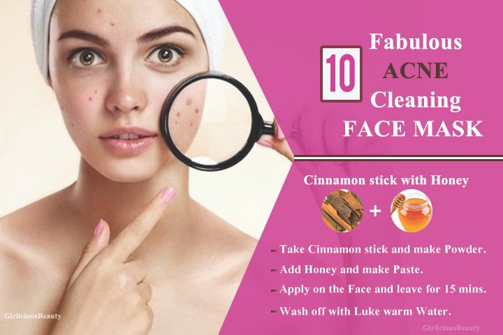 ACNE CLEANING FACE MASK1