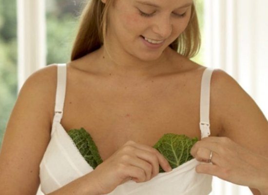 Cabbage Leaves for Breast engorgement