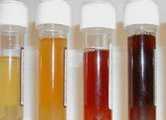 Change of urine color 