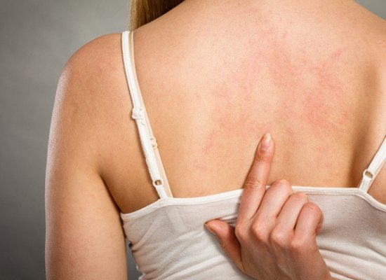 Dry and itchy skin 