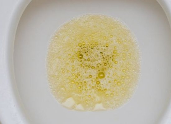 Urine is foamy 