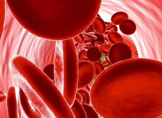 anaemia