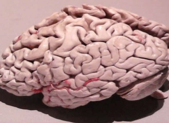 brain freshner