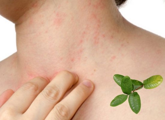 from itching