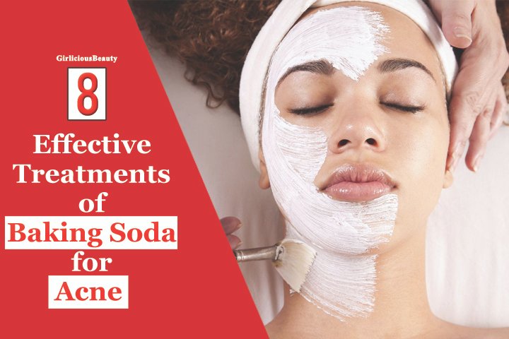 8 Interesting Ways Of Using Baking Soda For Treating Acne