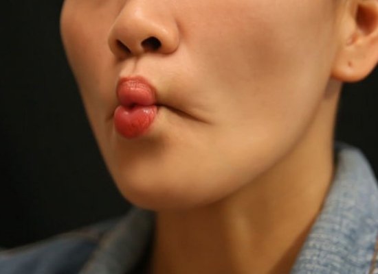Fish lips