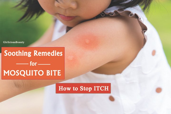 MOSQUITO BITE (1)