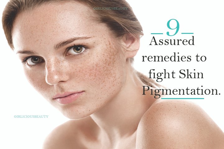 9 Assured Remedies To Get Rid Of Skin Pigmentation