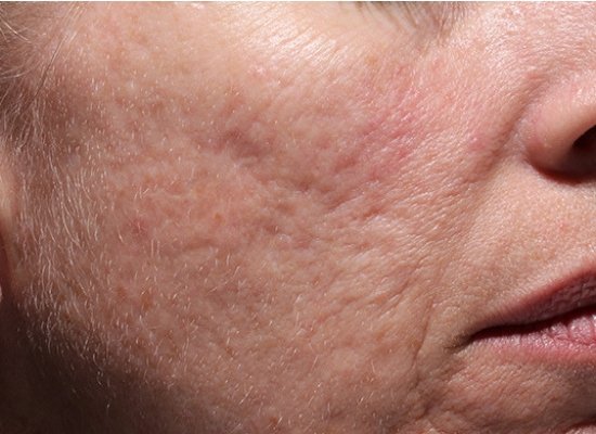 Treats blemishes and scars