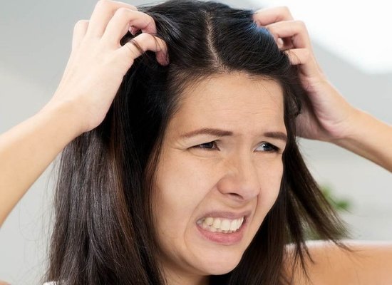 Fight dandruff