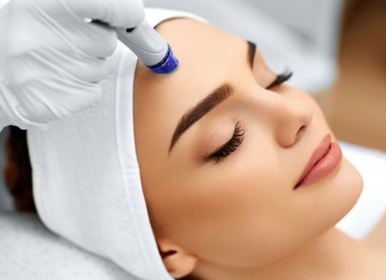 Microdermabrasion