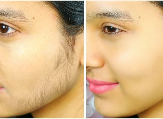 Unwanted hair on skin face mask