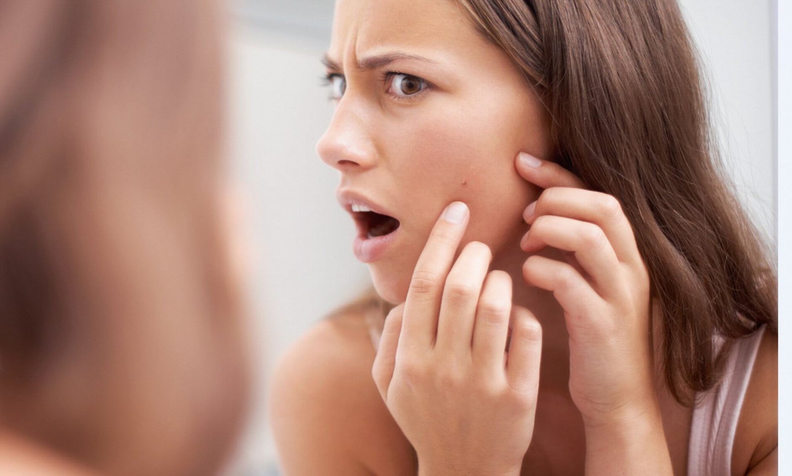 10 Surprising Factors That May Trigger an Acne