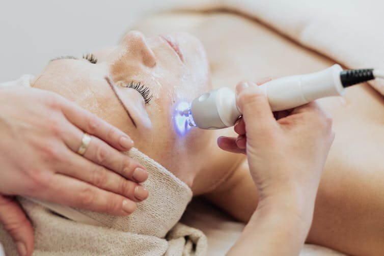 Laser Treatments in Melbourne: Things People Need to Know