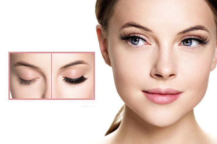 careprost-eyelashes (1)