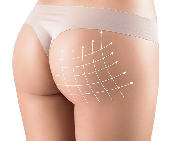 Butt Lift