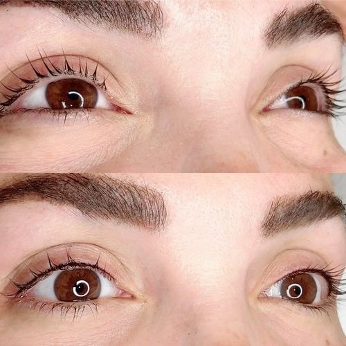 Eyelash line
