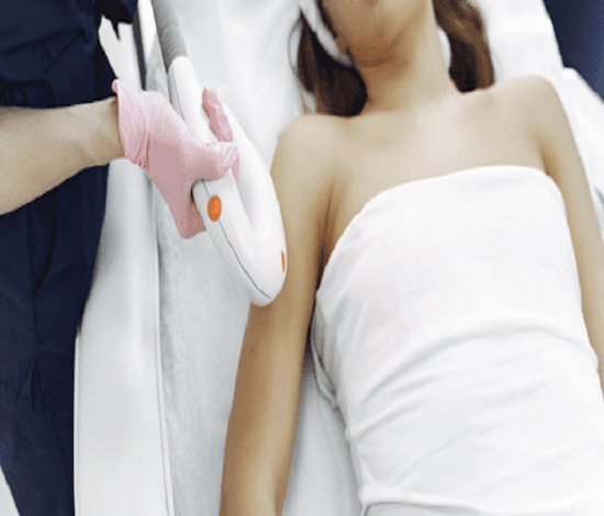 Laser Hair Removal