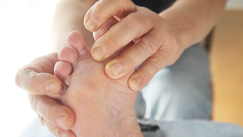 Diabetic Feet