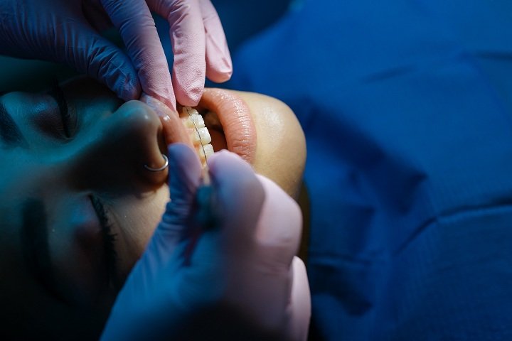 How to Choose the Best Dentist.