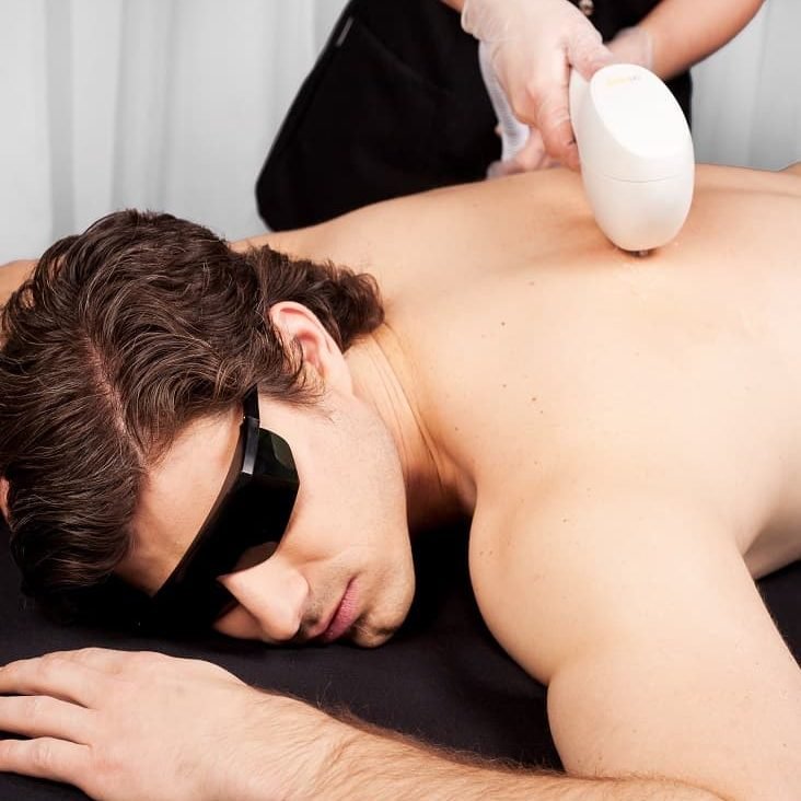 makeO skinnsi Permanent Laser Hair Reduction Review