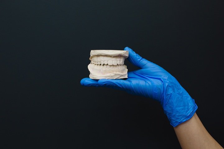 aligners