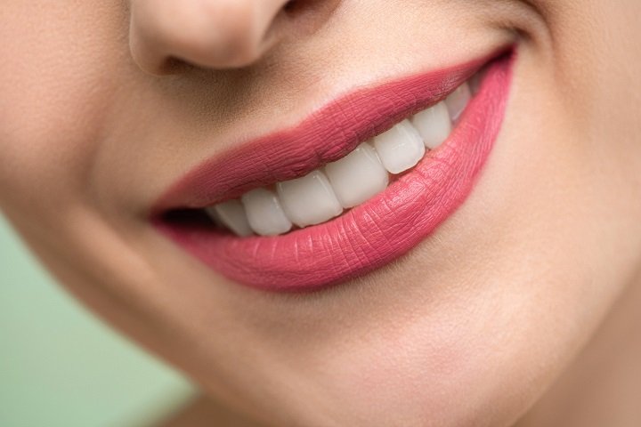 Teeth Brightening