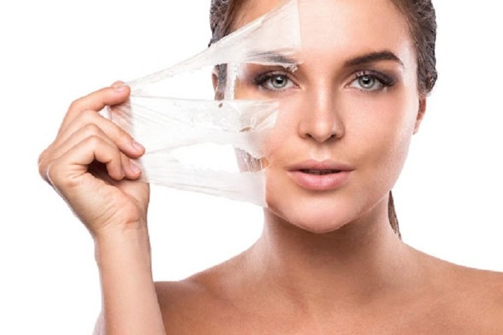Chemical Peel for Hyperpigmentation Concerns