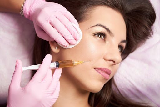 The Best Provider for Your Smile Lines Filler Treatment