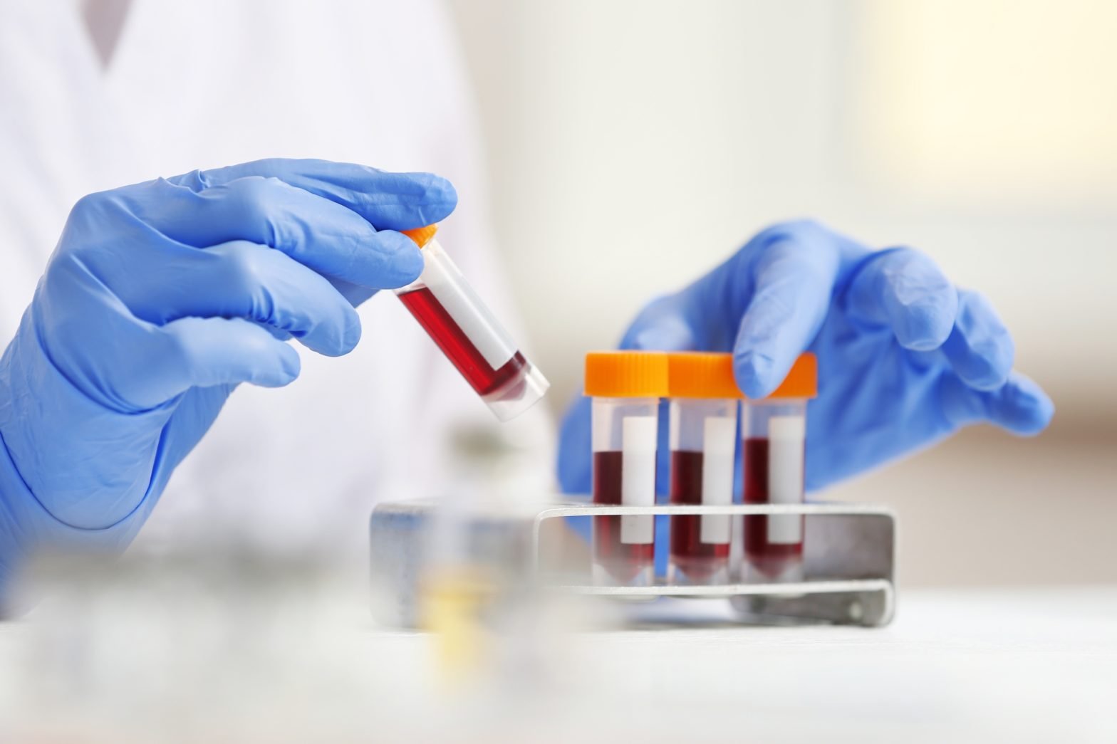 How Modern Technology Enhances CRP Test Accuracy